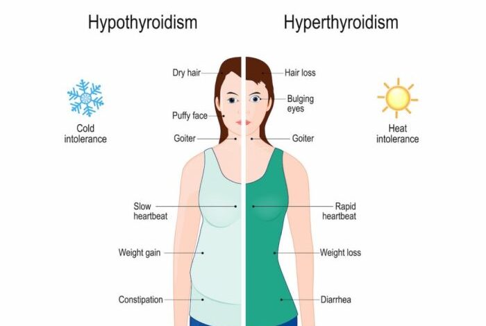 5 penyakit yang bisa menyerang kelenjar tiroid