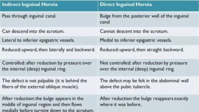 5 jenis hernia penyakit yang dikenal sebagai turun berok