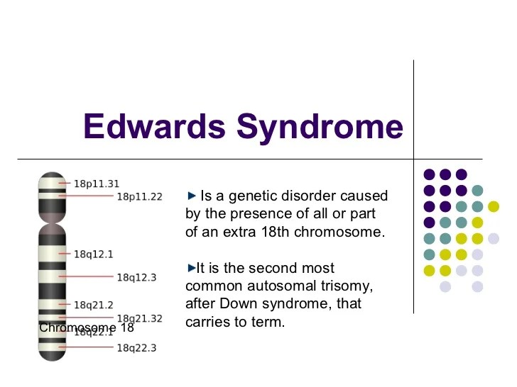 2 diagnosis sindrom edward setelah melahirkan