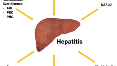 2 cara atasi radang hati akibat hepatitis d