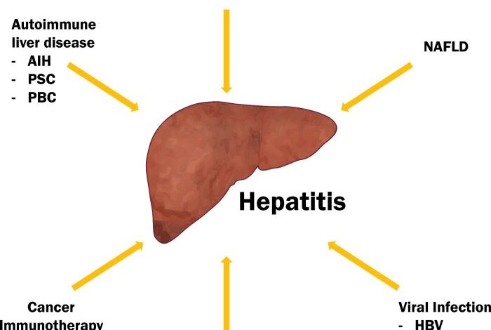 2 cara atasi radang hati akibat hepatitis d