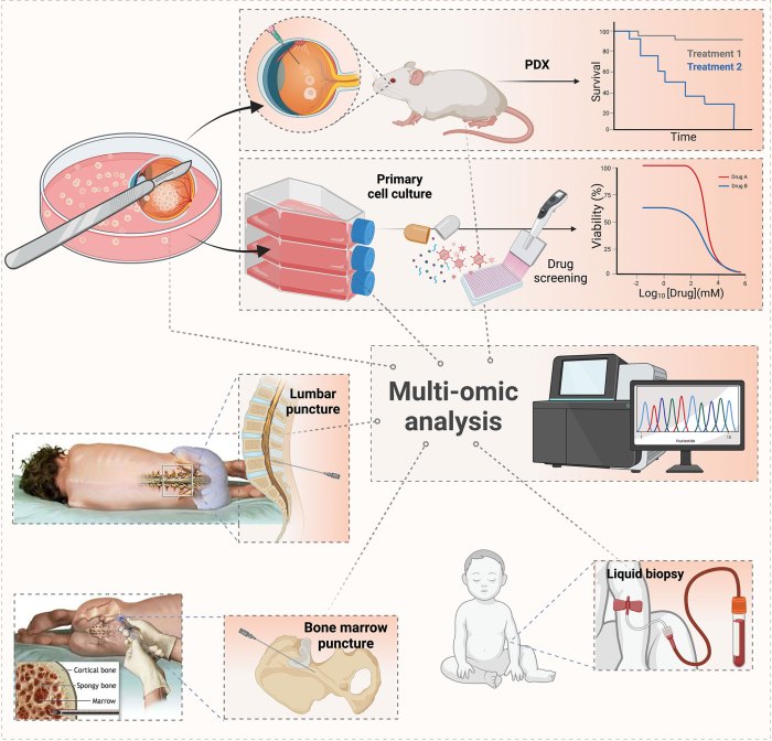 5 metode pengobatan untuk menangani retinoblastoma