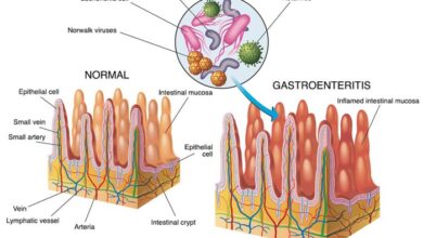 2 cara penularan gastroenteritis