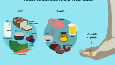 5 jenis makanan yang harus dihindari pengidap asam urat