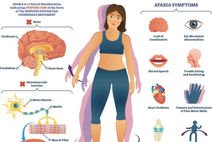 5 fakta ataksia friedreich yang perlu diketahui