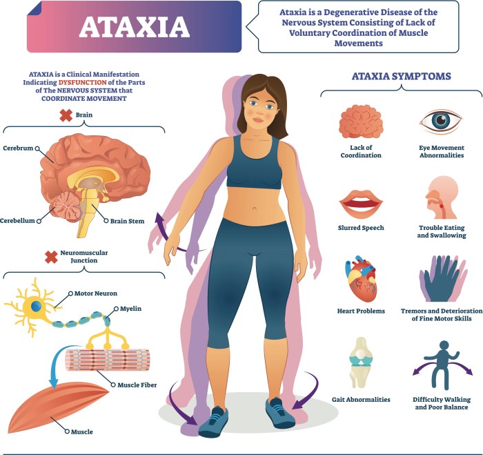 5 fakta ataksia friedreich yang perlu diketahui