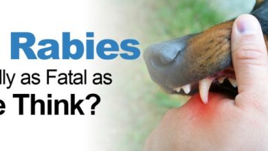 5 gejala awal rabies setelah digigit anjing yang terinfeksi