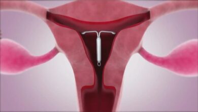 5 fakta tentang kontrasepsi iud yang perlu diketahui