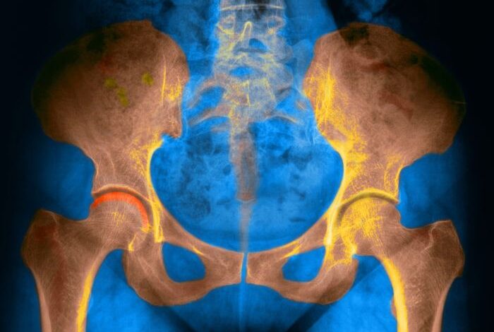 5 pemeriksaan untuk mendeteksi radang panggul