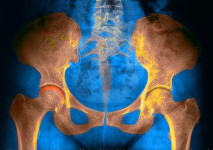 5 pemeriksaan untuk mendeteksi radang panggul