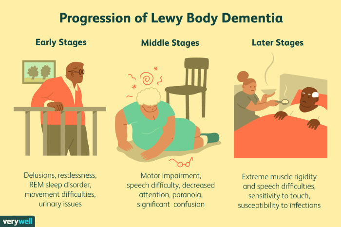 5 fakta tentang lewy body dementia yang terjadi pada lansia