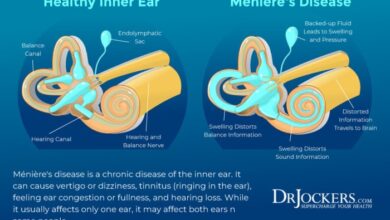 5 fakta tentang penyakit meniere yang perlu diketahui