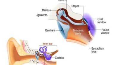 5 penyebab terjadinya perforasi membran timpani