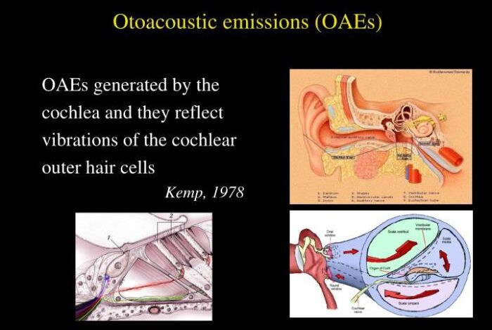 2 jenis otoacoustic emissions oae yang perlu diketahui