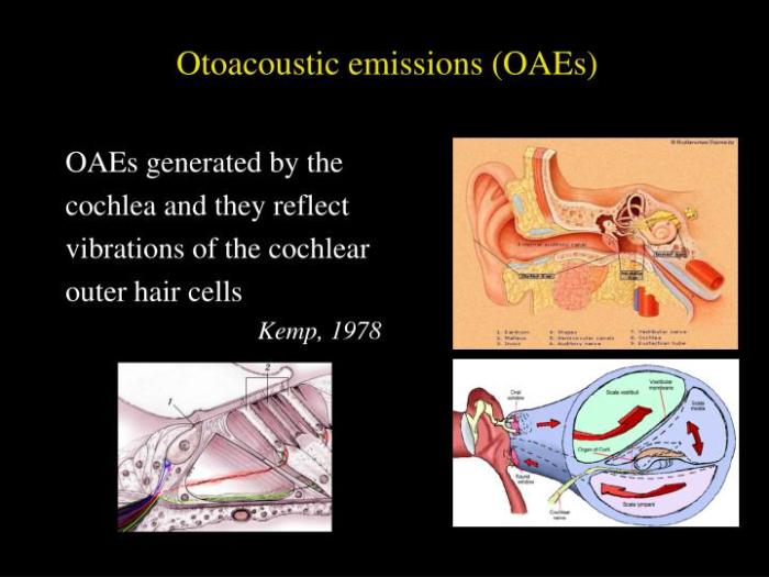 2 jenis otoacoustic emissions oae yang perlu diketahui