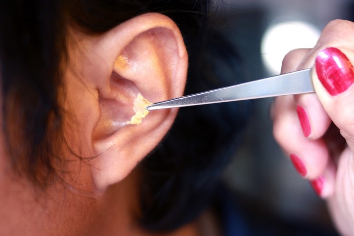 3 cara efektif membersihkan penumpukan ear wax