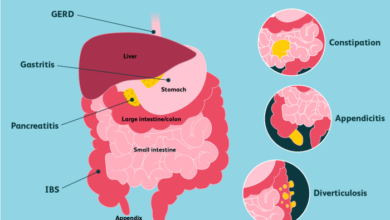 5 penyebab abdominal pain yang harus diwaspadai