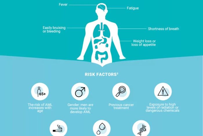 5 faktor yang tingkatkan risiko leukemia limfoblastik akut