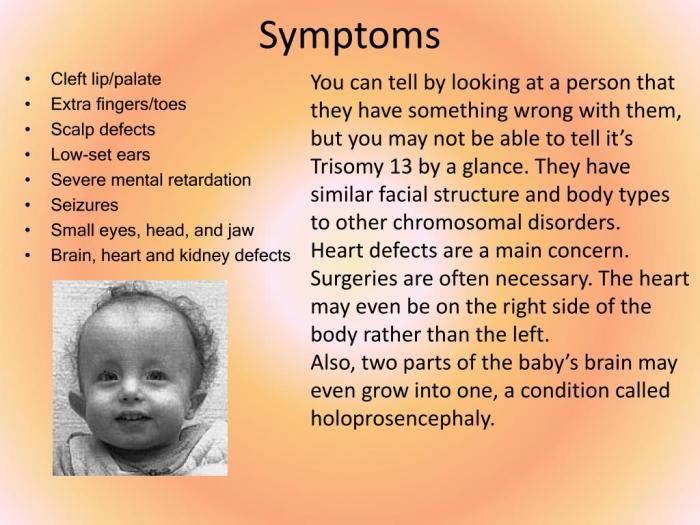 5 gejala trisomi 13 pada masa kehamilan