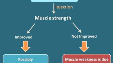 2 tes sederhana yang dapat dilakukan untuk deteksi myasthenia gravis