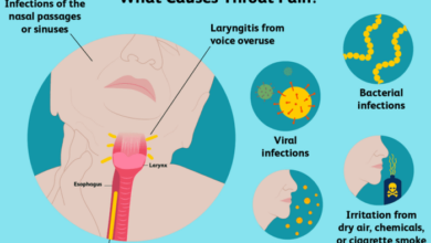 5 penyakit penyebab sakit tenggorokan sebelah kiri