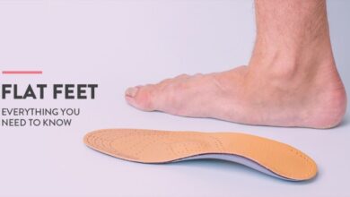 5 fakta menarik mengenai flat foot yang perlu diketahui