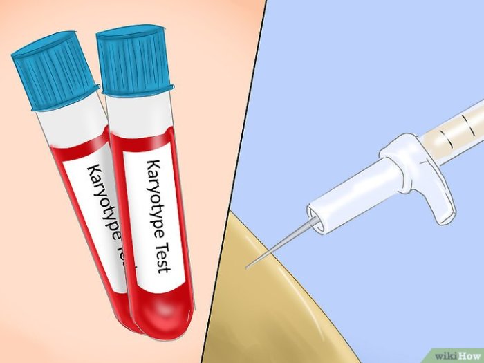 2 pemeriksaan untuk mendeteksi sindrom turner