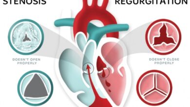 2 tipe penyakit katup jantung yang perlu diketahui