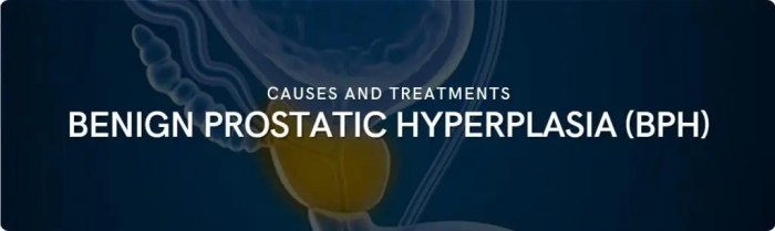 5 faktor ini tingkatkan risiko bph benign prostatic hyperplasia