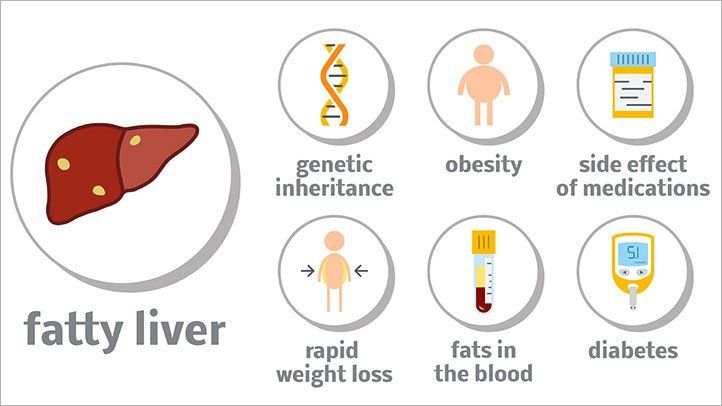 2 cara atasi radang hati akibat hepatitis d