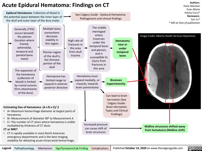 5 komplikasi akibat epidural hematoma