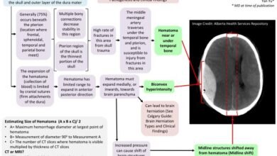 5 komplikasi akibat epidural hematoma