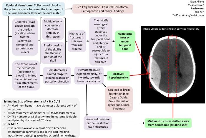 5 komplikasi akibat epidural hematoma