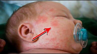 5 menu mpasi untuk bayi yang alergi susu