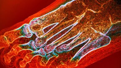 5 masalah pada kaki seiring bertambahnya usia