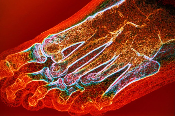 5 masalah pada kaki seiring bertambahnya usia