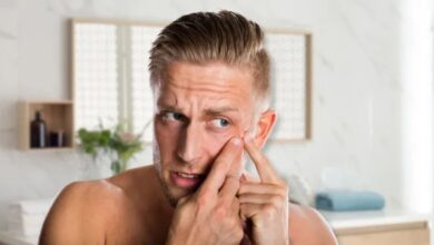 5 masalah kulit yang rentan dialami oleh pria