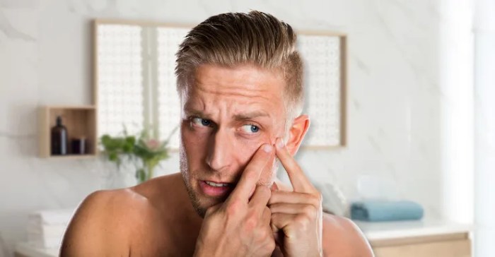 5 masalah kulit yang rentan dialami oleh pria
