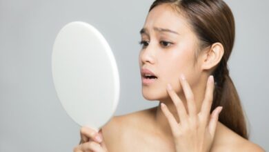 5 masalah kulit saat mudik yang perlu diketahui