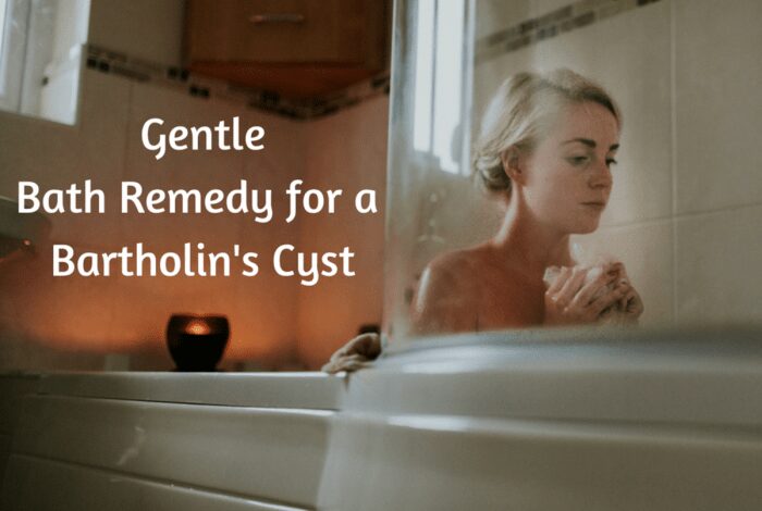 5 penanganan yang bisa dilakukan saat terkena kista bartholin