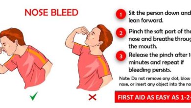 5 penanganan pertama saat anak alami mimisan