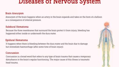 5 penyakit akibat kerusakan saraf