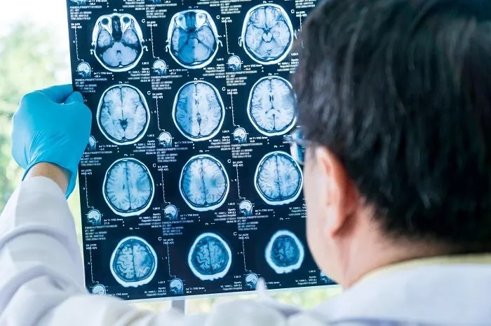 5 penyakit ini lebih mudah diketahui dengan mri