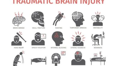 5 penyebab cedera kepala berat yang berakibat trauma