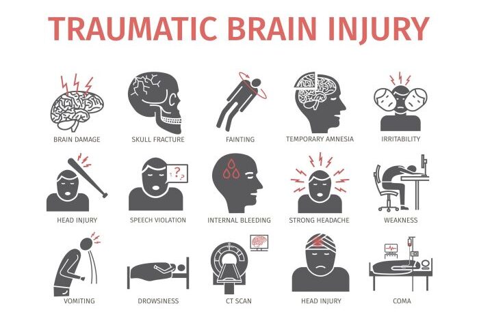5 penyebab cedera kepala berat yang berakibat trauma