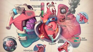 5 penyebab terjadinya nyeri dada pada wanita
