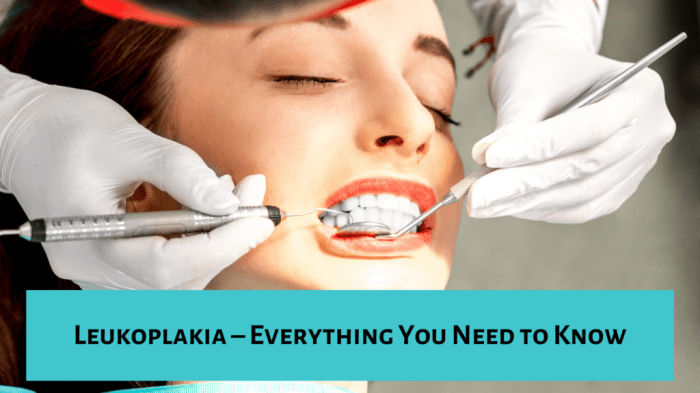 5 penyebab terjadinya leukoplakia yang perlu diketahui