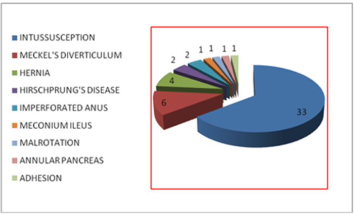 5 penyebab obstruksi usus terjadi pada anak anak
