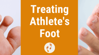 5 perawatan sederhana untuk mencegah kutu air