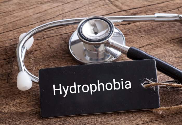 Hydrophobia fear addressing facty 5 pilihan pengobatan untuk gangguan hydrophobia